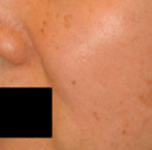 Before/After Image